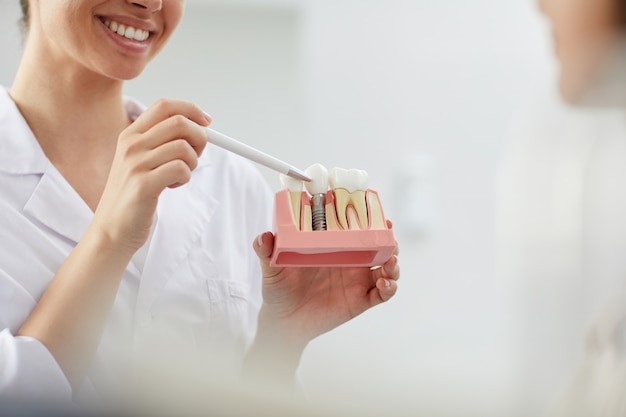 Best Dental Implants Clinic in Dubai