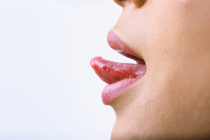 Tongue Ulcers 
