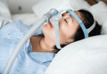 5 Tips to Prepare for Sleep Apnea Surgery Sleep Apnea Surgery