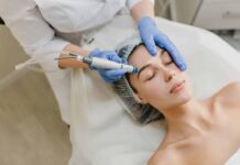 5 Skin Problems RF Microneedling Can Improve in Singapore RF Microneedling