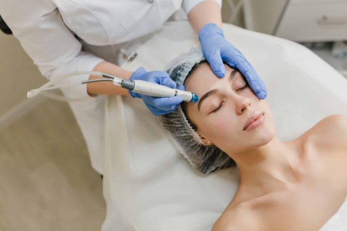 RF Microneedling